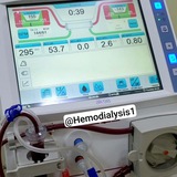 hemodialysis1 | Unsorted