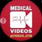 video_atm | Unsorted