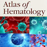 hematologyatlas | Unsorted