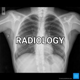 radiology_videos | Unsorted